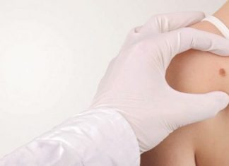 Αφαίρεση Σπίλων (Ελιές)