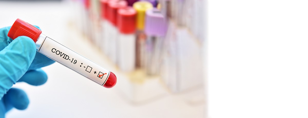 Ccoronavirus-test