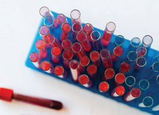 Αιματολογικές εξετάσεις στο Κέντρο Υγείας Δυτικής Φραγκίστας aimolipsia 1